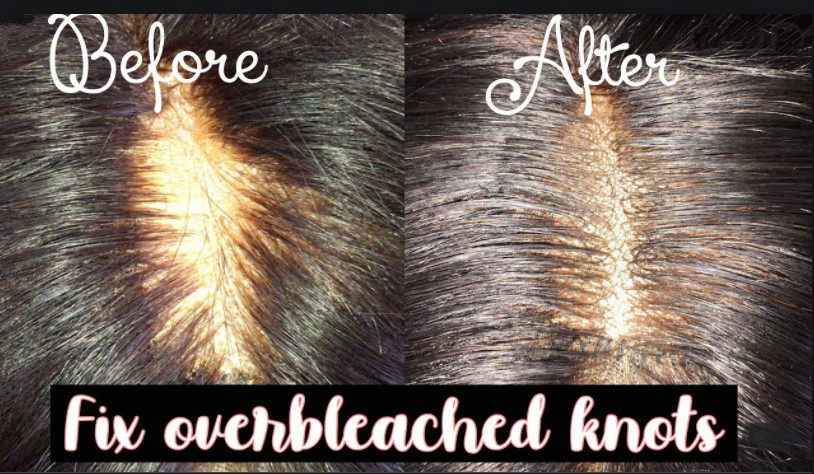 Lace Too Dark?  How To Fix Dark Lace quickly? – Myshinywigs
